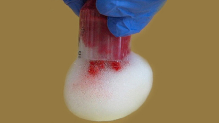 ايقاف النزيف