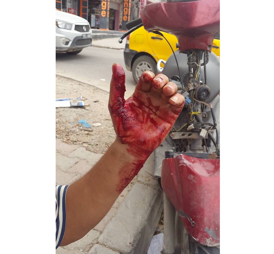 اصطدام سيارة تاكسي بمواطن من ذوي الاحتياجات الخاصة