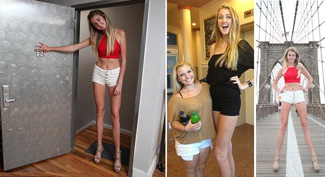 الفتاة "الزرافة" نحو غينتس .. طول ساقيها  126 سنتيمترا