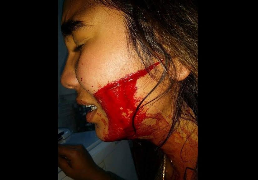 فتاة وجهها مشوه بشفرة حلاقة