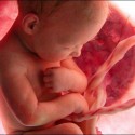 ولادة - إجهاض - رضيع