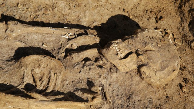 جثة آدمية - هيكل عظمي