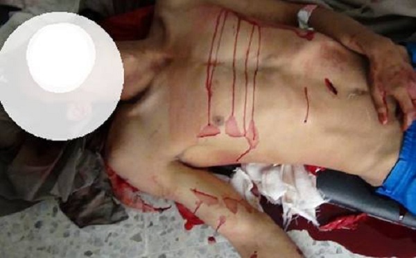 الاعتداء بألة حادة