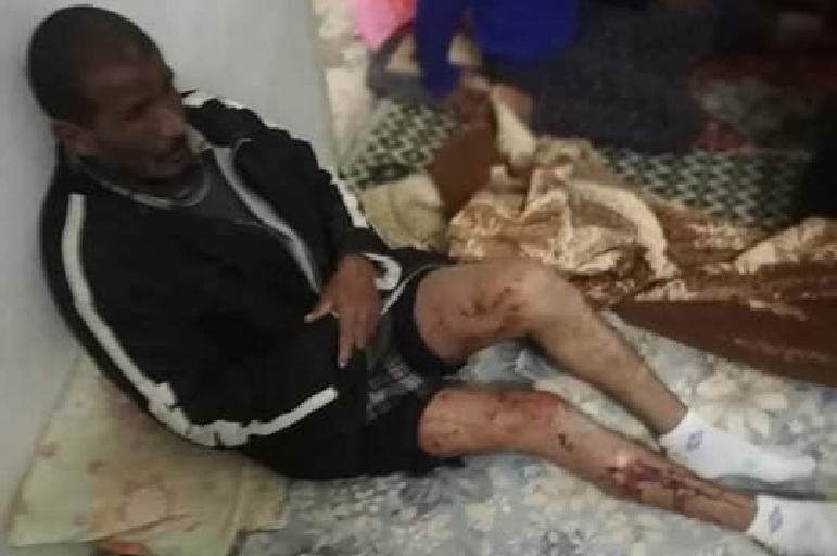 رجل - اصابة - طلق ناري