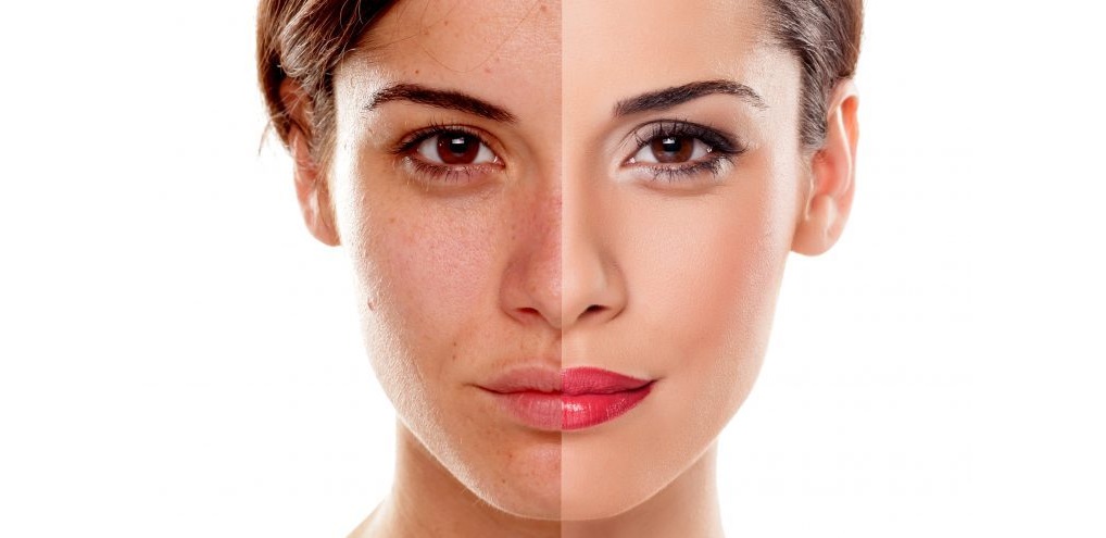 تغير لون الجلد