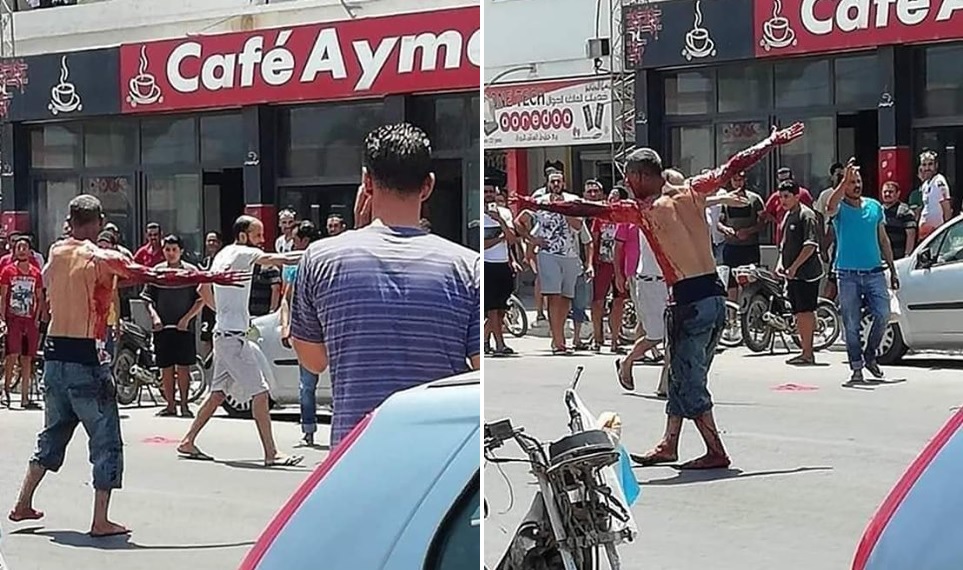 صفاقس : "بطال" يحوال الانتحار من خلال اصابة جسده بالة حادة