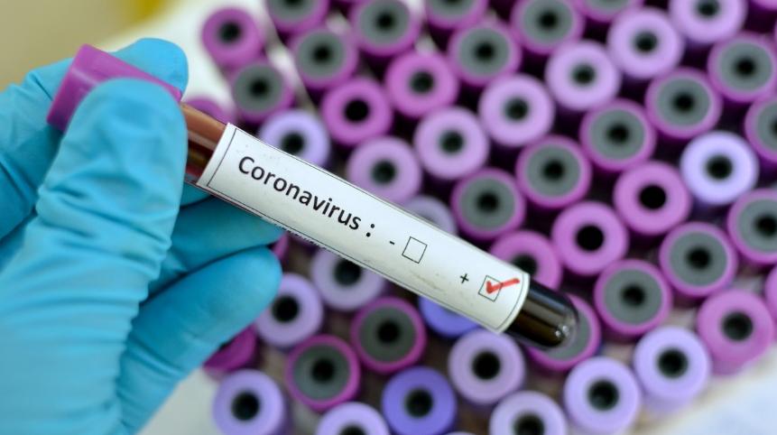 فيروس كورونا تحليل إيجابي إصابة