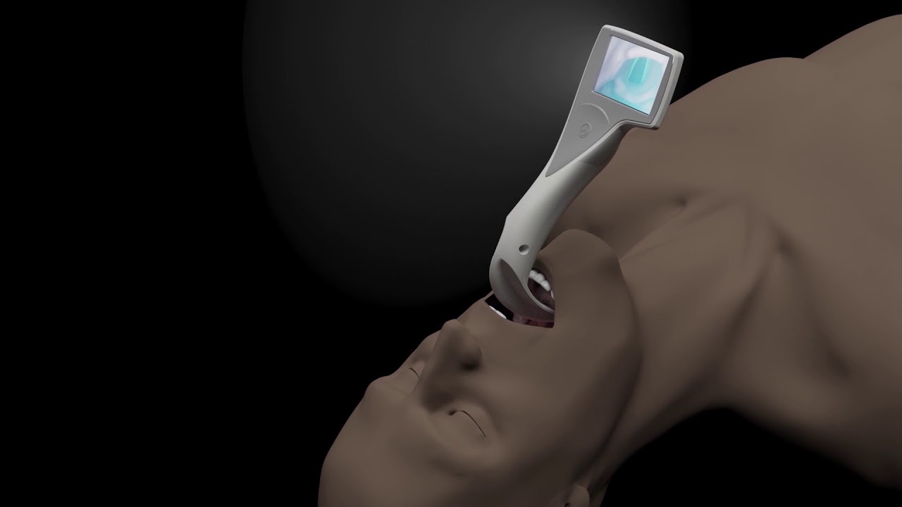 video laryngoscope