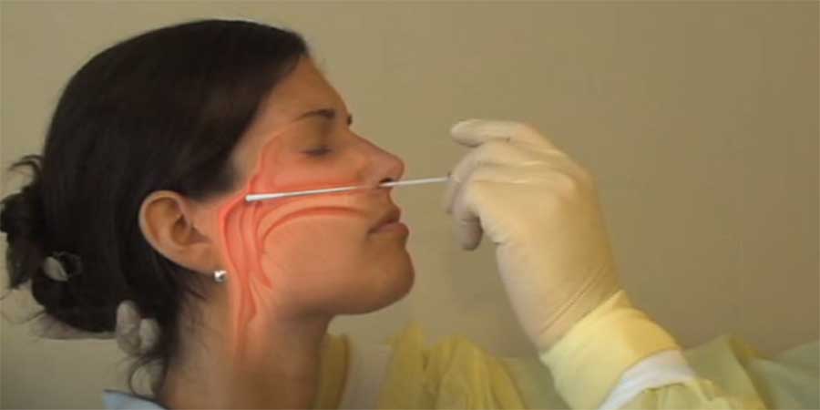 تحليل فيروس بكورونا